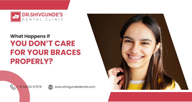 braces treatment in Solapur